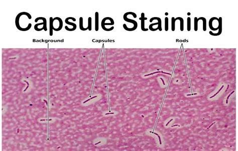 e coli capsule stain|capsule stain microbiology.